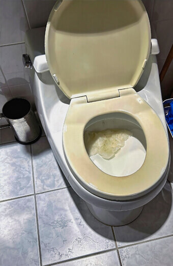 https://blockeddrainseastperth.com.au/uploads/2025/07/blocked-toilet-27293.jpg